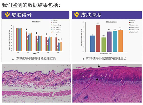JJB竞技宝建立的特应性皮炎及湿疹模型监测数据结果